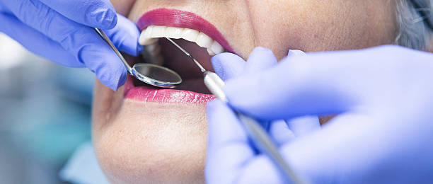 Best Emergency Dental Care for Broken or Chipped Teeth in Windsor Heights, IA